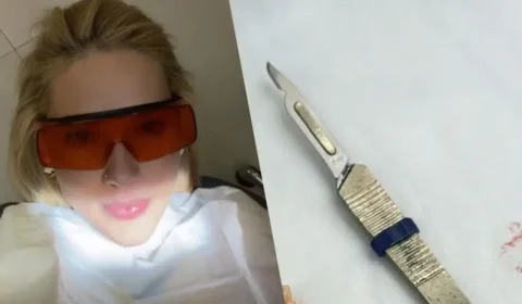 Virginia Fonseca faz microcirurgia após crise de enxaqueca e relata tratamento