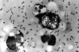 Rússia adota medidas contra possível peste após morte misteriosa; OMS cobra respostas