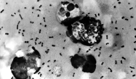 Rússia adota medidas contra possível peste após morte misteriosa; OMS cobra respostas