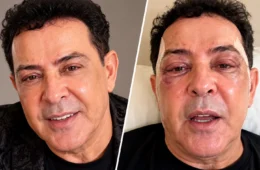 VÍDEO: Beto Barbosa surge com rosto irreconhecível após plástica e choca internet com novo visual