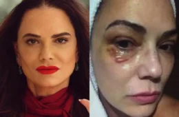 Luiza Brunet critica indenização de R$ 150 mil por agressão do ex e diz que valor é insuficiente