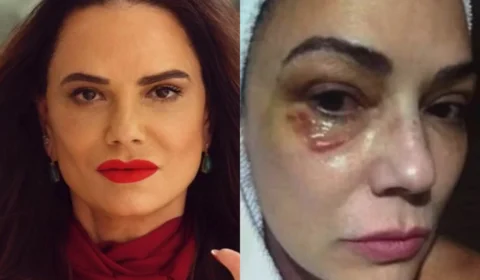 Luiza Brunet critica indenização de R$ 150 mil por agressão do ex e diz que valor é insuficiente