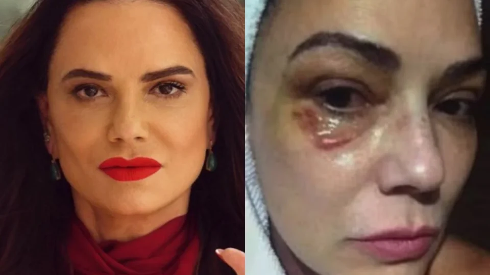 Luiza Brunet critica indenização de R$ 150 mil por agressão do ex e diz que valor é insuficiente