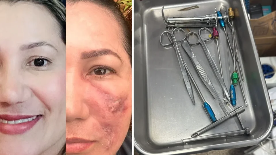 Falsa médica é presa após deixar paciente com rosto deformado no Amapá