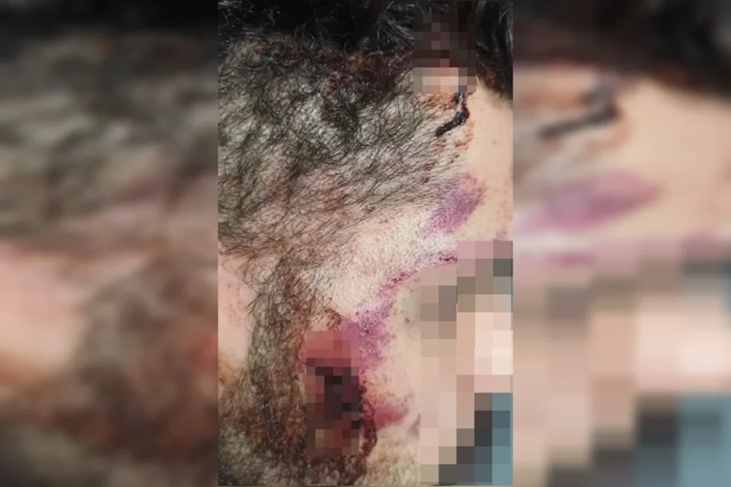 Vítima relatou ter sido ameaçada de morte e atingida com objeto, chutes e o triângulo do veículo; caso é investigado pela 4ª DP