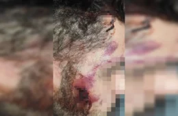 Motorista de aplicativo é agredido após discussão de trânsito no Guará
