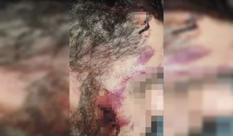 Motorista de aplicativo é agredido após discussão de trânsito no Guará