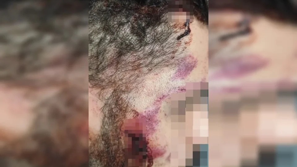 Motorista de aplicativo é agredido após discussão de trânsito no Guará