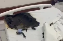 Paciente usa desodorante e isqueiro para atear fogo em homem internado no Rio