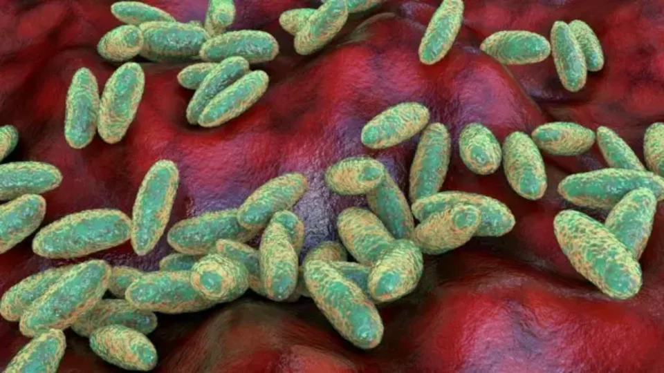 O que é a peste pneumônica, como ela se espalha e quais são os sintomas
