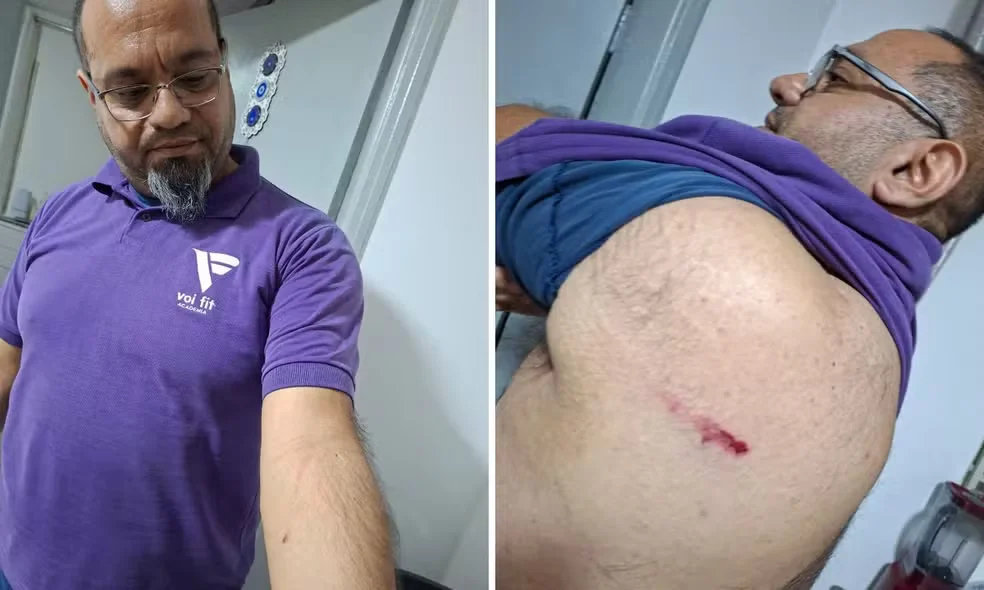 "Ele viu que a gente não estava dando bola, começou a bater no balcão, a nossa gerente começou a filmar, ele ficou nervoso, tentou agredí-la duas, três vezes, na quarta vez ele pega o notebook que está na mesa, dá um tapa no notebook, acerta o peito dela", disse.