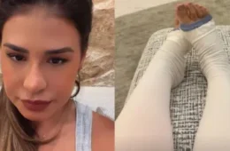 Simone Mendes revela retirada de 4 kg de pele em cirurgia ligada ao lipedema