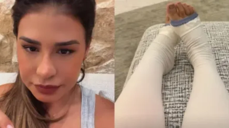 Simone Mendes revela retirada de 4 kg de pele em cirurgia ligada ao lipedema