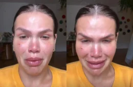 Após perder 120 kg, Thais Carla chora ao relembrar dificuldades: “Tudo foi muito dolorido”