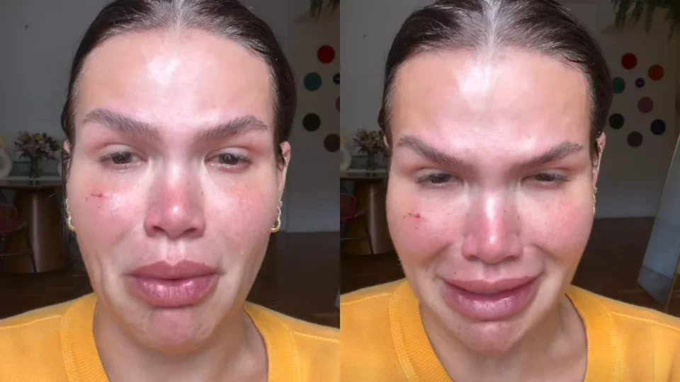 Após perder 120 kg, Thais Carla chora ao relembrar dificuldades: “Tudo foi muito dolorido”